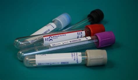 Should you get an at-home STD testing kit? | The Exeter Daily