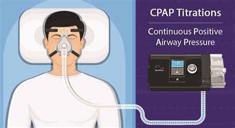 CPAP Titrations - Durbanville Sleep Lab