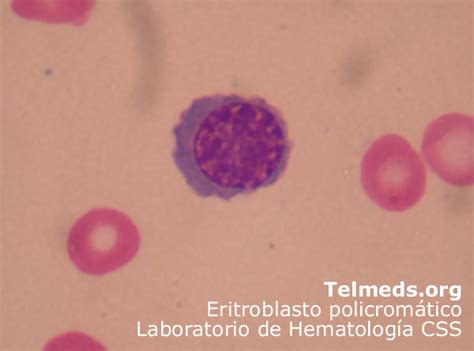 NORMOBLASTO POLICROMATOFILO | Biblioteca de Hematología