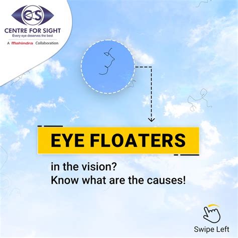 Understanding Eye Floaters