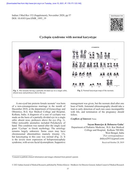 (PDF) Cyclopia syndrome with normal karyotype