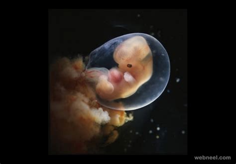 Embryo 7weeks Photo By Lennart Nilsson 10