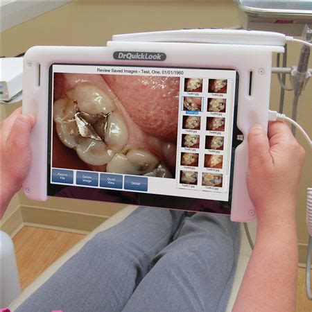 DrQuickLook Portable Dental Assistant Intraoral Camera System with Patient Education Videos ...