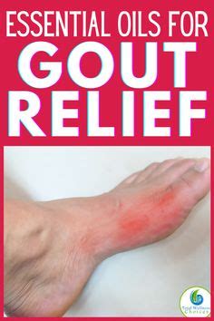 Gout prevention