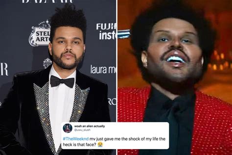 The Weeknd Plastic Surgery Video / The Weeknd leaves fans "frightened" after debuting a freaky ...