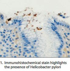 What are Immunohistochemical Stains? - Inform Diagnostics