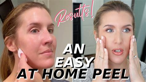 At Home Glycolic Acid Peel THAT WORKS! | Over 40 Skincare - YouTube