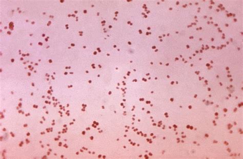 Neisseria Gonorrhoeae Gram Stain