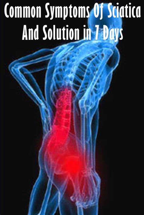 Proven Exercises and Treatment to help remedy sciatica in 7 Days: Common Symptoms Of Sciatica