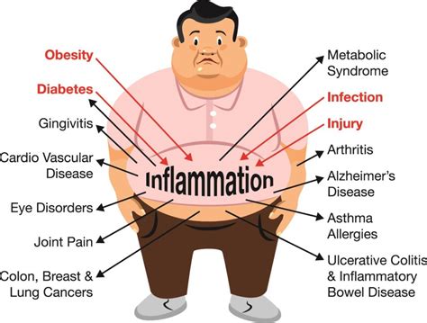 Inflammation: Disease Begins in Your Gut? – Naked Biotics