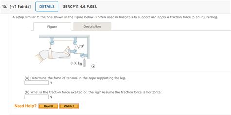 Solved (b) What is the traction force exerted on the leg? | Chegg.com