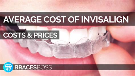 Average Cost of Invisalign - Prices & Averages 2023 - BracesBoss