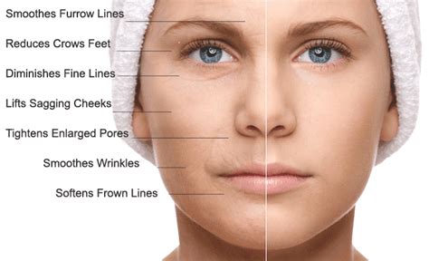 Stem Cell/PRP Facial Rejuvenation - New Image Advanced Laser Skin Center - Las Vegas