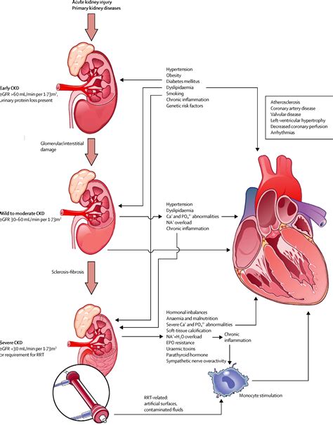 Chronic kidney disease and cardiovascular risk: epidemiology ...