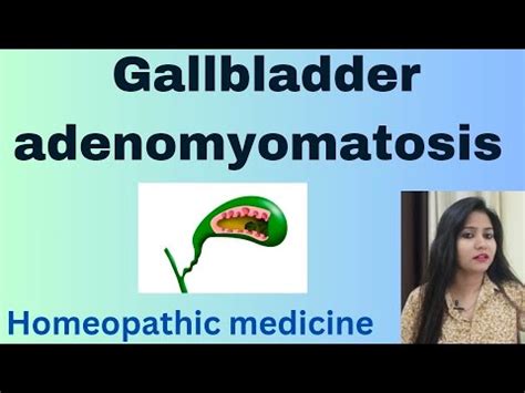 Gallbladder adenomyomatosis treatment ! Adenomyomatosis symptoms,cause & Homeopathic medicine ...