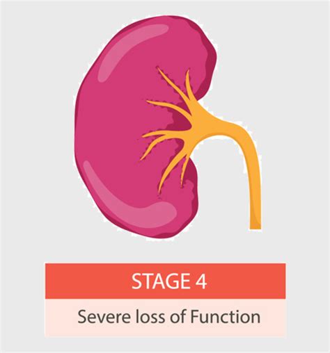 what to know about chronic kidney disease stage 4(CKD)