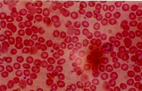 Blood Type Under Microscope - Blood Type Relation