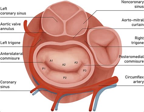 Frontiers | Direct Percutaneous Mitral Annuloplasty in Patients With Functional Mitral ...