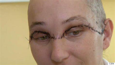 Woman Scalped In Horrific Power Drill Accident Can Smile Again After Life-Saving Surgery ...