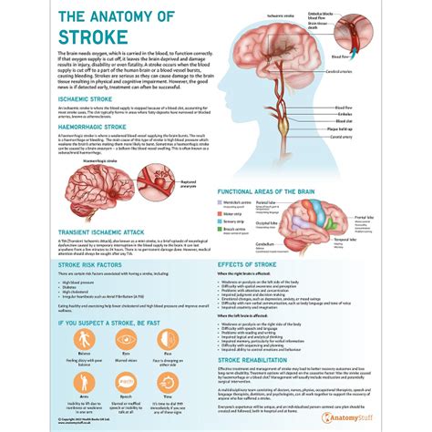 The Anatomy of Stroke | Neuro Pathology Education | AnatomyStuff