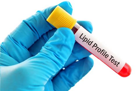 What is Lipid Profile? - Dr Lal PathLabs Blog