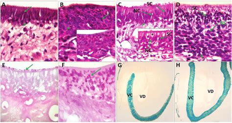 Nonciliated Pseudostratified Columnar Epithelium