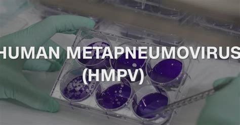 HMPV symptoms: How to know if you have human metapneumovirus and how to ...