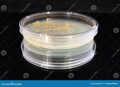 A Petri Dish with Common Yeast and Bacteria Colonies Stock Image ...