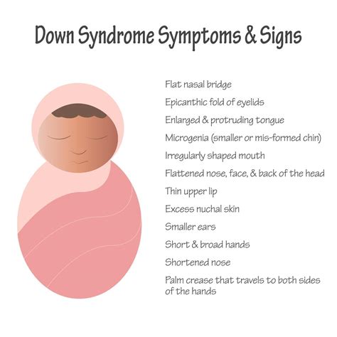 Down Syndrome Symptoms and Signs in Newborns 8131476 Vector Art at Vecteezy