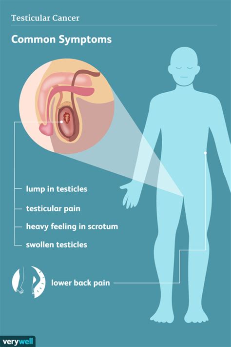 Signs, Symptoms, and Complications of Testicular Cancer