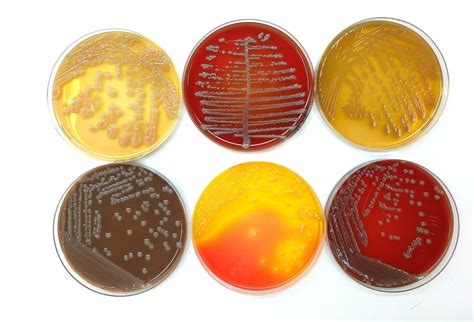 Culture Media In Microbiology - Solution Parmacy