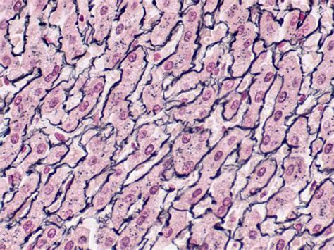 RETICULUM Control Histology Slides - Newcomer Supply