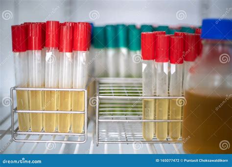 Test Tube for Bacterial Culture in Cool Incubator Laboratory Stock ...