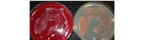 Pink-colored mucus secreting Roseomonas mucosa colonies on a blood agar... | Download Scientific ...