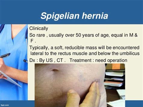 Abdominal wall hernia