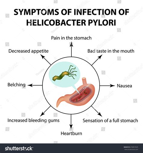 Symptoms Infection Helicobacter Pylori Infographics Vector: vector de stock (libre de regalías ...