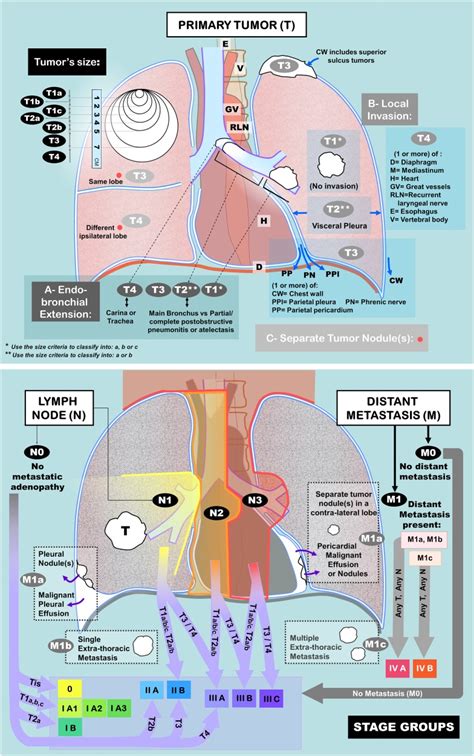 The Eighth Edition of TNM Staging of Lung Cancer: Reference Chart and Diagrams. - Abstract ...