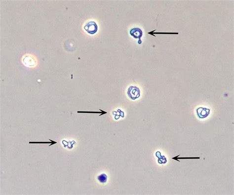 Bacteria In Urine Under Microscope