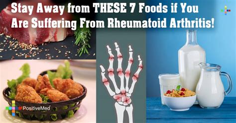 THESE 7 Foods if You Are Suffering From Rheumatoid Arthritis