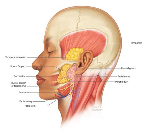 Buccal Fat Pad Reduction With Intraoperative Fat Transfer to the Temple ...