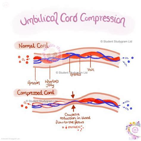 The Umbilical Cord Collection – Digital Downloads – Student Midwife ...