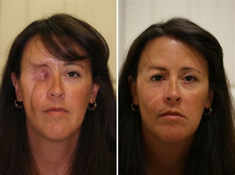 What do you think about FACIAL plastic surgery? - Bodybuilding.com Forums