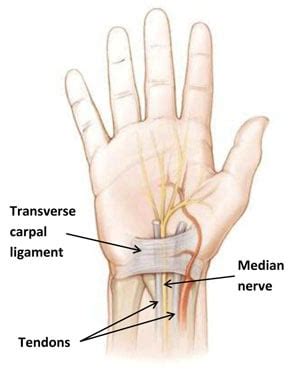 Carpal Tunnel Syndrome: Symptoms, Causes & Treatment