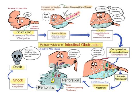 Acute intestinal obstruction: Pathophysiology - Creative Med Doses