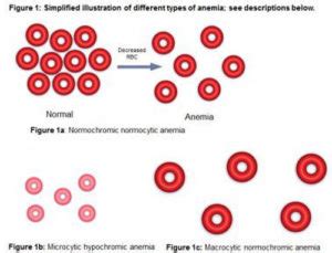 👉 MCHC Blood Test -What does it mean, Normal range (Low, High) (November 2021)