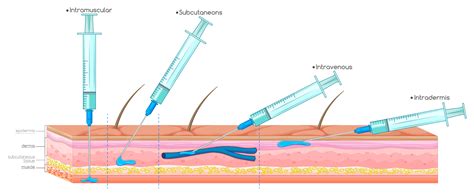 Diagram showing injection with syringe 418969 Vector Art at Vecteezy