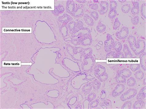 Testis and Epididymis – Normal Histology – NUS Pathweb :: NUS Pathweb