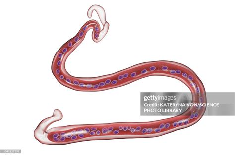 Brugia Malayi Parasitic Worm Illustration High-Res Vector Graphic ...