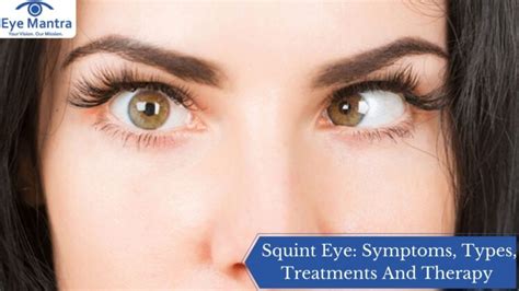 Squint Eye Treatment | Symptoms, Types, And Therapy