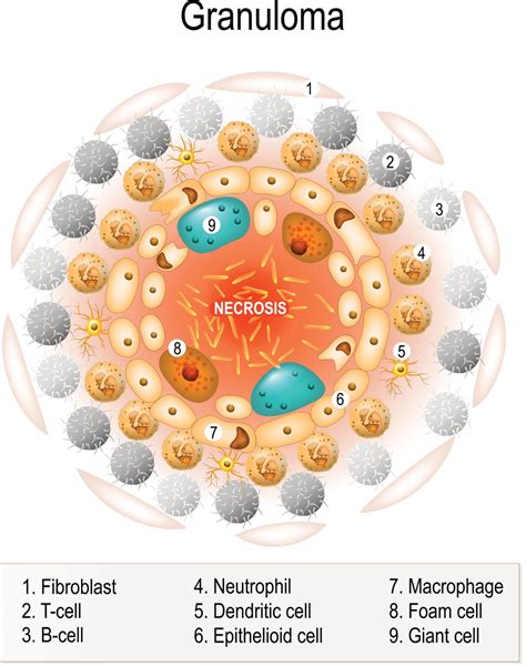 Delayed T cell Response Allows Tuberculosis to Gain Foothold in Monkeys | The Scientist Magazine®